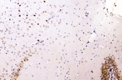 IHC staining of FFPE rat brain with HNRNPA2B1 antibody. HIER: boil tissue sections in pH8 EDTA for 20 min and allow to cool before testing.