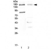 Western blot testing of 1) rat pancreas and 2) mouse NIH 3T3 lysate with NPC1 antibody at 0.5ug/ml. Expected molecular weight: 140-190 kDa depending on glycosylation level.