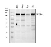 NEDD4 Antibody Western Blot A549 HaCaT RT4 U251 Cells. Western blot analysis of Neural precursor cell expressed developmentally down-regulated protein 4 / NEDD4 in human cell lysates using NEDD4 Antibody for WB. Lane 1: A549 whole cell lysate, Lane 2: HaCaT whole cell lysate, Lane 3: RT4 whole cell lysate, Lane 4: U251 whole cell lysate. A band is detected at approximately 145-150 kDa, consistent with the predicted molecular weight of NEDD4, with additional lower molecular weight bands likely representing cleavage products or isoforms. The banding pattern aligns with reported NEDD4 expression and post-translational processing observed in human cells.