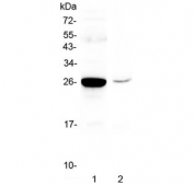 Western blot testing of mouse 1) liver and 2) HEPA1-6 lysate with Mbl2 antibody at 0.5ug/ml. Predicted molecular weight: ~26 kDa.