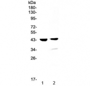 Western blot testing of 1) mouse testis and 2) rat testis lysate with Cathepsin D / CTSD antibody at 0.5ug/ml. Expected molecular weight: 43-46 kDa, 28 kDa (heavy chain), 15 kDa (light chain).