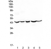 Western blot testing of human 1) HeLa, 2) placenta, 3) HepG2, 4) 22RV1 and 5) U-2 OS cell lysate with HMBS antibody at 0.5ug/ml. Predicted molecular weight: ~39 kDa.