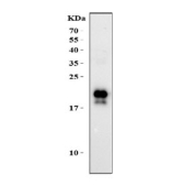 Western blot testing of human U-2 OS cell lysate with NPC2 antibody at 0.5ug/ml. Predicted molecular weight: ~17 kDa, can be observed as a ~21/23 kDa doublet in human samples. (Ref 1).