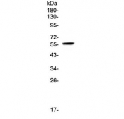 Western blot testing of human SW579 lysate with FGR antibody at 0.5ug/ml. Predicted molecular weight: ~59 kDa, routinely observed at 55~59 kDa.