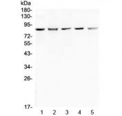 Western blot testing of human 1) HeLa, 2) 293T, 3) COLO-320, 4) SW620 and 5) MCF7 cell lysate with RNF43 antibody at 0.5ug/ml. Predicted molecular weight: ~86 kDa (isoform 1), ~95 kDa (isoform 4).