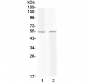 Western blot testing of 1) rat liver and 2) mouse liver with PROC antibody at 0.5ug/ml. Predicted molecular weight ~52 kDa.