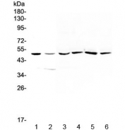 Western blot testing of 1) human HepG2, 2) human A549, 3) rat liver, 4) rat kidney, 5) mouse liver and 6) mouse kidney tissue with HGD antibody at 0.5ug/ml. Predicted molecular weight ~50 kDa.