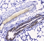 IHC testing of FFPE rat lung tissue with Betacellulin antibody at 1ug/ml. Required HIER: steam section in pH6 citrate buffer for 20 min and allow to cool prior to staining.