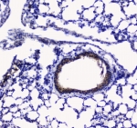 IHC testing of FFPE mouse lung tissue with Betacellulin antibody at 1ug/ml. Required HIER: steam section in pH6 citrate buffer for 20 min and allow to cool prior to staining.