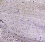IHC testing of FFPE rat brain tissue with Betacellulin antibody at 1ug/ml. Required HIER: steam section in pH6 citrate buffer for 20 min and allow to cool prior to staining.