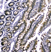 IHC staining of FFPE rat small intestine tissue with RAB6A antibody at 1ug/ml. HIER: boil tissue sections in pH6, 10mM citrate buffer, for 10-20 min followed by cooling at RT for 20 min.