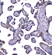 IHC staining of FFPE human placental tissue with RAB6A antibody at 1ug/ml. HIER: boil tissue sections in pH6, 10mM citrate buffer, for 10-20 min followed by cooling at RT for 20 min.