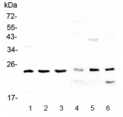 Western blot testing of 1) human MDA-MB-453, 2) human SK-OV-3, 3) human A431, 4) rat testis, 5) mouse brain and 6) mouse HEPA1-6 lysate with RAB6A antibody at 0.5ug/ml. Predicted molecular weight ~24 kDa.
