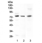 Western blot testing of human 1) HeLa, 2) COLO-320 and 3) mouse HEPA1-6 cell lysate with LGALS3BP antibody at 0.5ug/ml. Expected molecular weight: 65-90 kDa depending on glycosylation level.