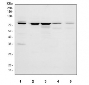 Western blot testing of 1) human HeLa, 2) human 293T, 3) human HepG2, 4) rat brain and 5) mouse brain tissue lysate with LGALS3BP antibody at 0.5ug/ml. Expected molecular weight: 65-90 kDa depending on glycosylation level.