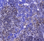 IHC testing of FFPE mouse spleen tissue with SHIP1 antibody at 1ug/ml. Required HIER: steam section in pH6 citrate buffer for 20 min and allow to cool prior to staining.