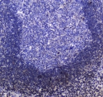IHC testing of FFPE human tonsil tissue with SHIP1 antibody at 1ug/ml. Required HIER: steam section in pH6 citrate buffer for 20 min and allow to cool prior to staining.