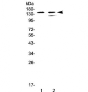 Western blot testing of human 1) CCRF-CEM and 2) SW620 cell lysate with SHIP1 antibody at 0.5ug/ml. Predicted molecular weight ~133 kDa, commonly observed at ~145 kDa.