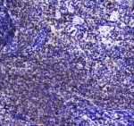 IHC testing of FFPE rat spleen tissue with SHIP1 antibody at 1ug/ml. Required HIER: steam section in pH6 citrate buffer for 20 min and allow to cool prior to staining.