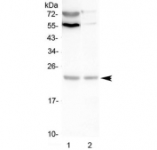 Western blot testing of 1) rat C6 and 2) mouse Neuro-2a lysate with LMO2 antibody at 0.5ug/ml. Predicted molecular weight ~18 kDa (isoform 1), ~25 kDa (isoform 3).
