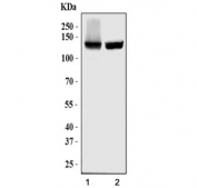 Western blot testing of human 1) Raji and 2) Daudi cell lysate with PLCG2 antibody. Predicted molecular weight ~148 kDa.