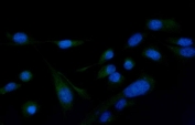 Immunofluorescent staining of FFPE human U-2 OS cells with PLCG2 antibody (green) and DAPI nuclear stain (blue). HIER: steam section in pH6 citrate buffer for 20 min.
