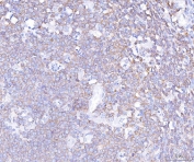 IHC staining of FFPE human tonsil tissue with PLCG2 antibody. HIER: boil tissue sections in pH8 EDTA for 20 min and allow to cool before testing.