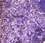 IHC testing of FFPE mouse spleen tissue with Annexin VI antibody at 1ug/ml. Required HIER: steam section in pH6 citrate buffer for 20 min and allow to cool prior to staining.