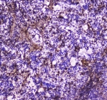 IHC testing of FFPE rat spleen tissue with Annexin VI antibody at 1ug/ml. Required HIER: steam section in pH6 citrate buffer for 20 min and allow to cool prior to staining.