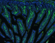 Immunofluorescent staining of FFPE mouse intestine with Annexin VI antibody (green) at 1ug/ml and DAPI nuclear stain (blue). HIER: steam section in pH6 citrate buffer for 20 min.