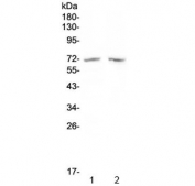 Western blot testing of human 1) MDA-MB-453 and 2) SW620 cell lysate with HDAC10 antibody at 0.5ug/ml. Predicted molecular weight ~71 kDa.