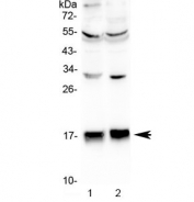 Western blot testing of human 1) HepG2 and 2) SGC-7901 lysate with COX4I1 antibody at 0.5ug/ml. Predicted molecular weight ~20 kDa.