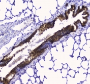 IHC testing of FFPE rat lung tissue with COX4I1 antibody at 1ug/ml. Required HIER: steam section in pH6 citrate buffer for 20 min and allow to cool prior to staining.
