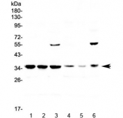 Western blot testing of 1) rat spleen, 2) rat lung, 3) rat testis, 4) mouse spleen, 5) mouse lung and 6) mouse testis lysate with JUND antibody at 0.5ug/ml. Predicted molecular weight: ~39 kDa (JUND-L), 34 kDa (JUND-S).