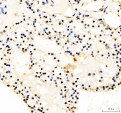 Western blot testing of human 1) placenta and 2) Jurkat lysate with JUND antibody at 0.5ug/ml. Predicted molecular weight: ~39 kDa (JUND-L), 34 kDa (JUND-S).