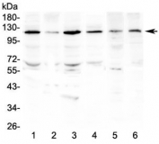 Western blot testing of human 1) HeLa, 2) HepG2, 3) SGC-7901, 4) K562, 5) rat testis and 6) mouse testis lysate with PDGFRB antibody at 0.5ug/ml. Expected molecular weight: 123-190 kDa depending on level of glycosylation.