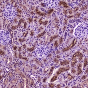IHC testing of FFPE rat kidney tissue with PDGFRB antibody at 2 ug/ml. HIER: boil tissue sections in pH6, 10mM citrate buffer, for 10-20 min followed by cooling at RT for 20 min.