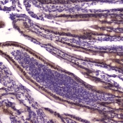 IHC testing of FFPE rat small intestine tissue with KLF4 antibody at 2ug/ml. HIER: boil tissue sections in pH6, 10mM citrate buffer, for 10-20 min followed by cooling at RT for 20 min.