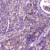 IHC testing of FFPE mouse spleen tissue with KLF4 antibody at 2ug/ml. HIER: boil tissue sections in pH6, 10mM citrate buffer, for 10-20 min followed by cooling at RT for 20 min.