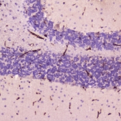 IHC testing of FFPE human cerebellum tissue with C-Reactive Protein antibody at 2ug/ml. HIER: boil tissue sections in pH6, 10mM citrate buffer, for 10-20 min followed by cooling at RT for 20 min.