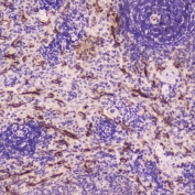 IHC testing of FFPE human spleen tissue with C-Reactive Protein antibody at 2ug/ml. HIER: boil tissue sections in pH6, 10mM citrate buffer, for 10-20 min followed by cooling at RT for 20 min.