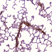 IHC testing of FFPE human lung tissue with C-Reactive Protein antibody at 2ug/ml. HIER: boil tissue sections in pH6, 10mM citrate buffer, for 10-20 min followed by cooling at RT for 20 min.
