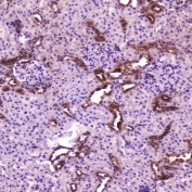 IHC testing of FFPE rat kidney with p65 antibody at 2ug/ml. HIER: boil tissue sections in pH6, 10mM citrate buffer, for 10-20 min followed by cooling at RT for 20 min.