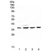 Western blot testing of human 1) HeLa, 2) SGC-7901, 3) K562 and 4) mouse SP2/0 lysate with Cdk6 antibody at 0.5ug/ml. Expected molecular weight: 36-40 kDa.