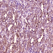 IHC testing of FFPE rat kidney tissue with Leptin antibody at 2ug/ml. HIER: boil tissue sections in pH6, 10mM citrate buffer, for 10-20 min followed by cooling at RT for 20 min.