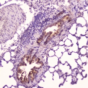 IHC testing of FFPE rat lung tissue with Leptin antibody at 2ug/ml. HIER: boil tissue sections in pH6, 10mM citrate buffer, for 10-20 min followed by cooling at RT for 20 min.