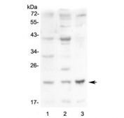 Western blot testing of 1) mouse small intestine, 2) mouse kidney and 3) mouse Neuro-2a lysate with Leptin antibody at 0.5ug/ml. Predicted molecular weight ~16 kDa.