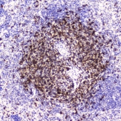 IHC testing of FFPE mouse spleen tissue with CD5 antibody at 2ug/ml. HIER: boil tissue sections in pH6, 10mM citrate buffer, for 10-20 min followed by cooling at RT for 20 min.