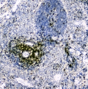 IHC testing of FFPE rat spleen tissue with CD5 antibody at 2ug/ml. HIER: boil tissue sections in pH6, 10mM citrate buffer, for 10-20 min followed by cooling at RT for 20 min.