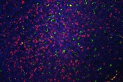 Immunofluorescent staining of FFPE rat brain with CD68 mAb (green), CD5 antibody (red) at 1ug/ml and DAPI nuclear stain (blue). HIER: steam section in pH6 citrate buffer for 20 min.